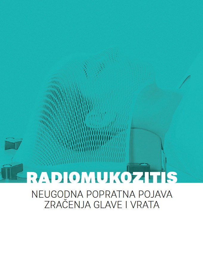 Slika za: Radiomukozitis – neugodna popratna pojava zračenja glave i vrata